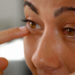 Gonfiore sotto gli occhi con rimedi naturali: tipologie e soluzioni efficaci.